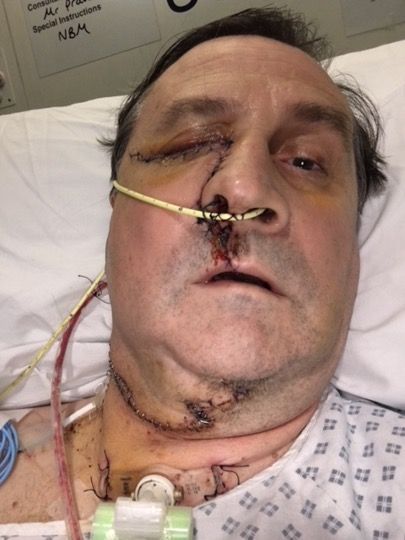 Mark Allen post op pic 1.jpg